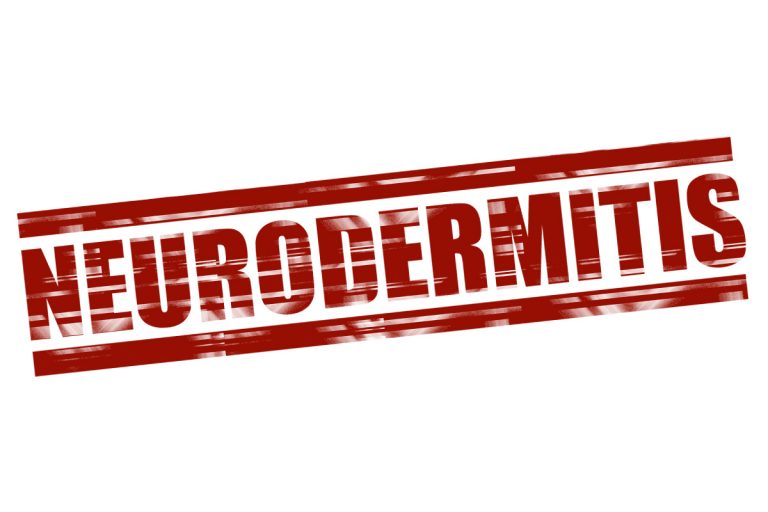 Neurodermitis