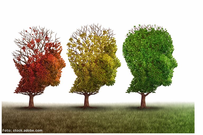 Alzheimer