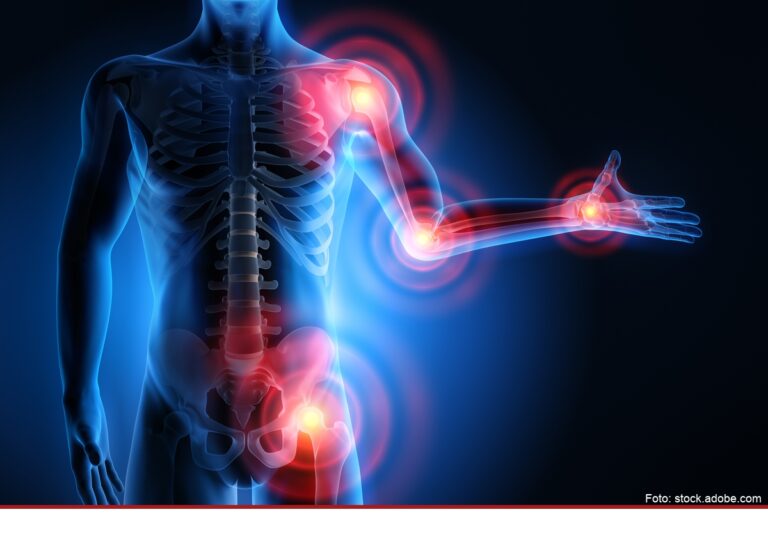 App-Unterstützung bei Arthrose